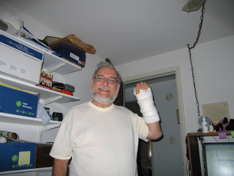 1_Me_with_hand_bandaged_small.jpg