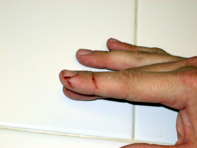 200832061023_finger.jpg