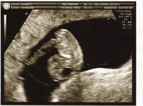 Ultrasound1-1.jpg