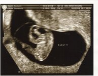 Ultrasound1-2.jpg