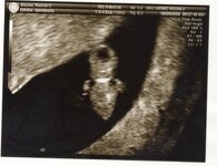 Ultrasound1-3.jpg